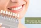 Teeth Whitening Science