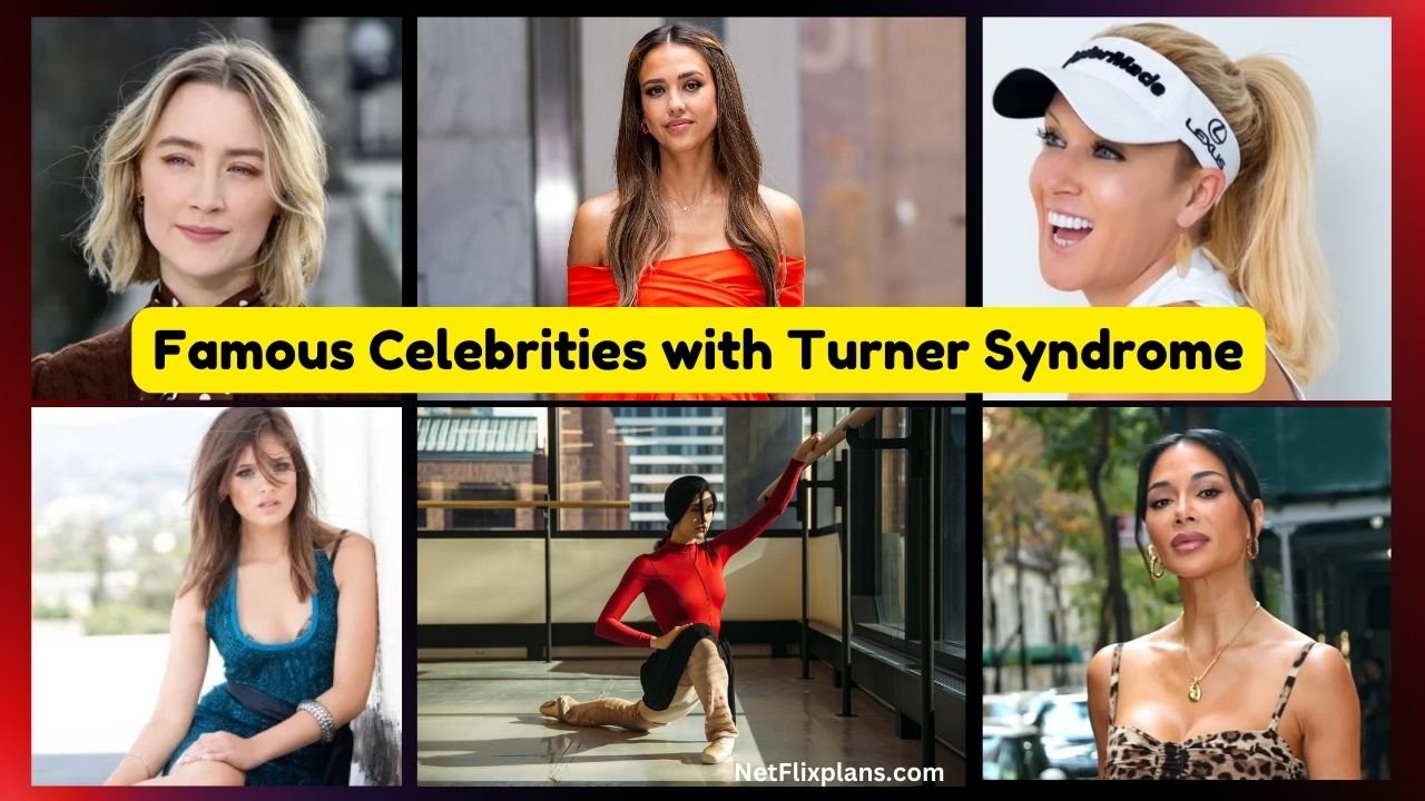 Famous Celebrities with Turner Syndrome